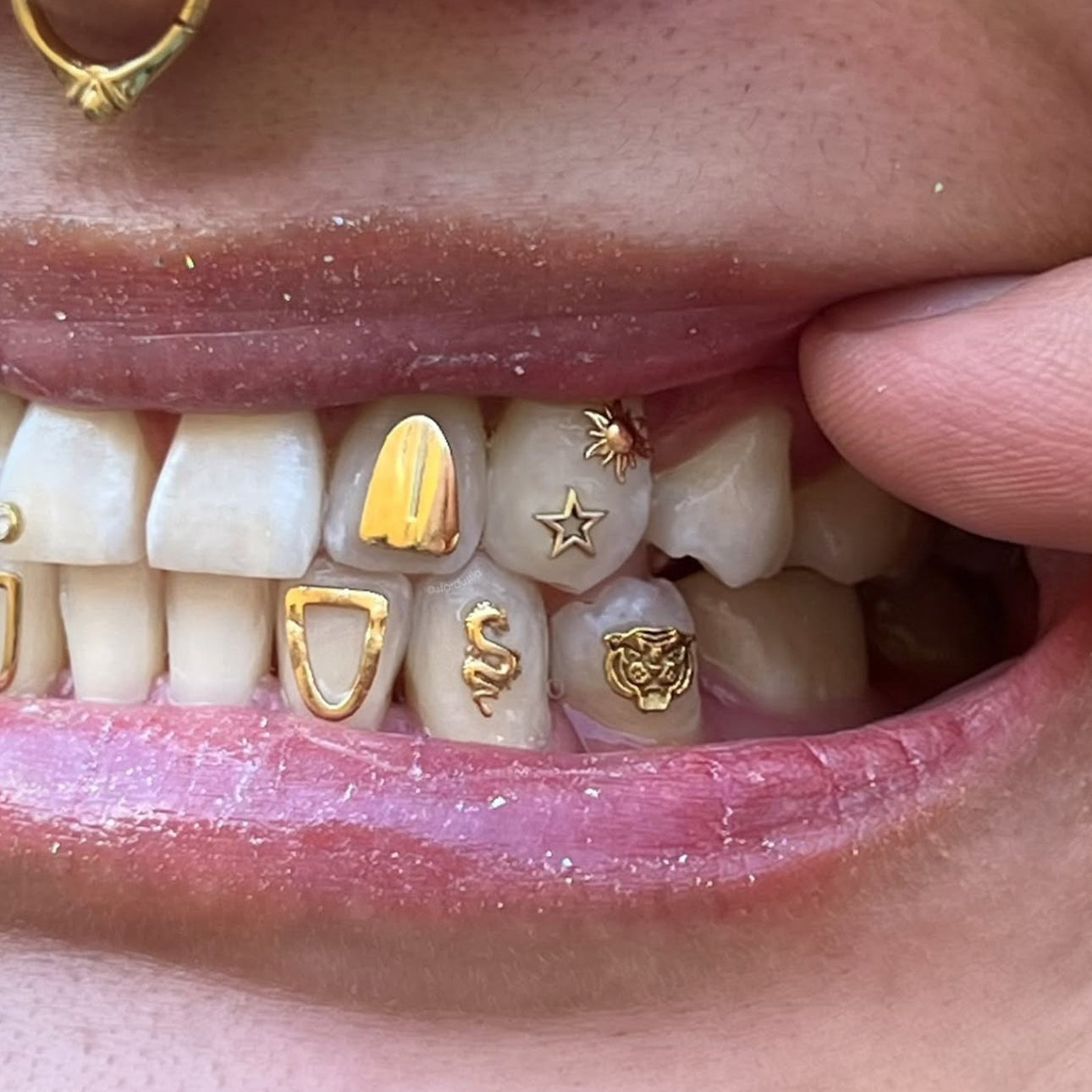 tooth gems, tooth charms, gold teeth gems, gold tooth charms, 18k tooth gems, teeth gems, Swarovski tooth gems, tooth gem application, diamond gems, diamond tooth gems, nike tooth gem, star tooth gem, heart tooth gem, twinkles tooth gems, tooth kandy, dentluxe, sparkle by maya, wholesale tooth gems, tooth gems australia, tooth gems Melbourne, tooth gem training, tooth gem course, mouth house, tooth gem application, temporary tooth gems