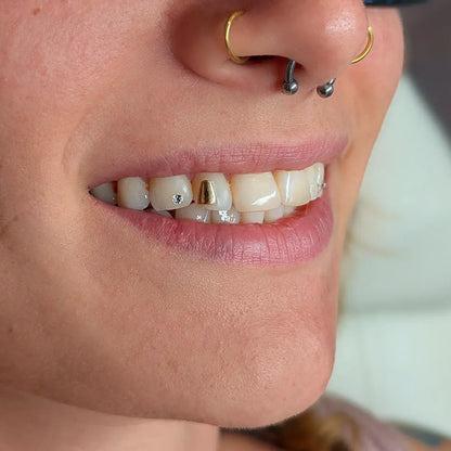 tooth gems, tooth charms, gold teeth gems, gold tooth charms, 18k tooth gems, teeth gems, Swarovski tooth gems, tooth gem application, diamond gems, diamond tooth gems, nike tooth gem, star tooth gem, heart tooth gem, twinkles tooth gems, tooth kandy, dentluxe, sparkle by maya, wholesale tooth gems, tooth gems australia, tooth gems Melbourne, tooth gem training, tooth gem course, mouth house, tooth gem application, temporary tooth gems