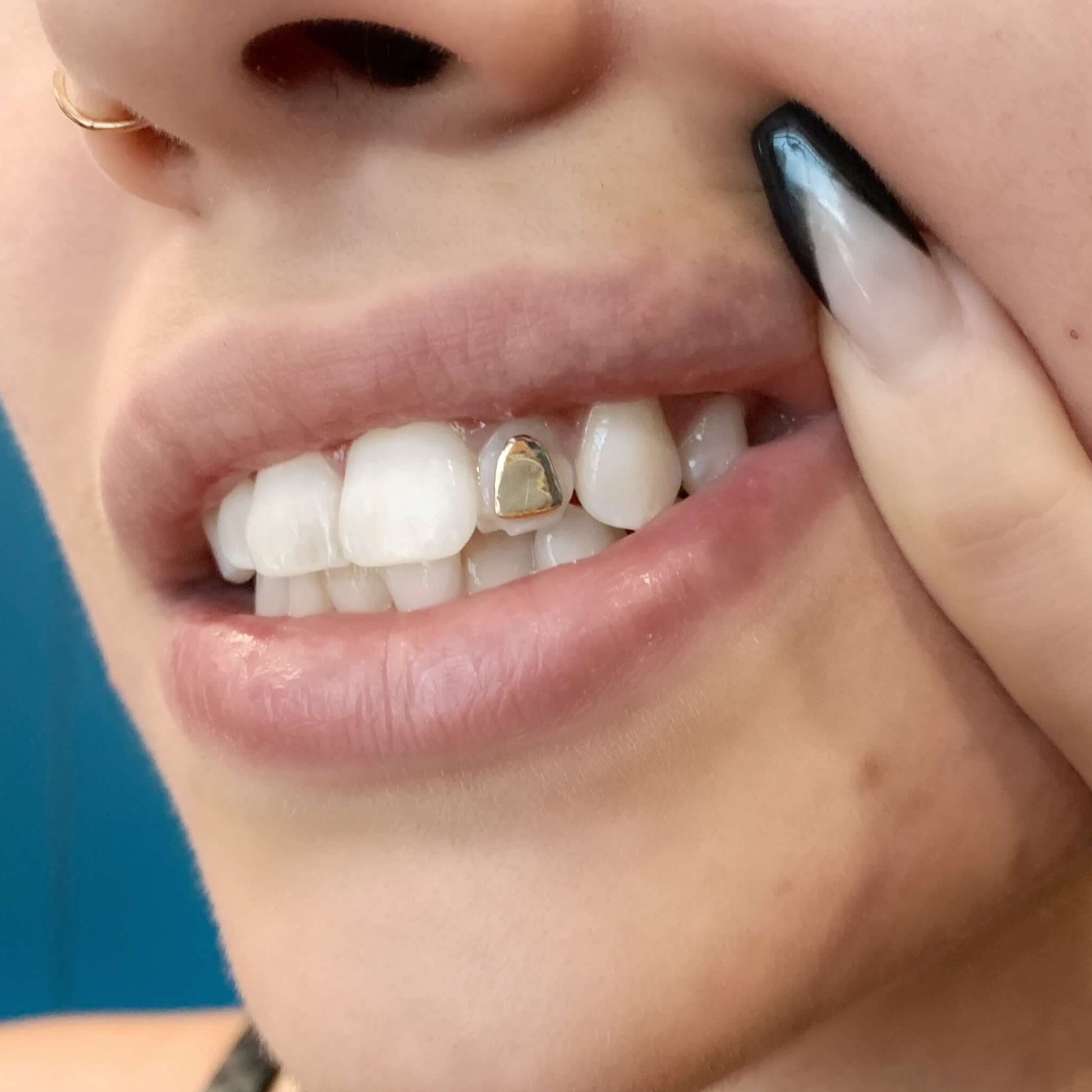 tooth gems, tooth charms, gold teeth gems, gold tooth charms, 18k tooth gems, teeth gems, Swarovski tooth gems, tooth gem application, diamond gems, diamond tooth gems, nike tooth gem, star tooth gem, heart tooth gem, twinkles tooth gems, tooth kandy, dentluxe, sparkle by maya, wholesale tooth gems, tooth gems australia, tooth gems Melbourne, tooth gem training, tooth gem course, mouth house, tooth gem application, temporary tooth gems