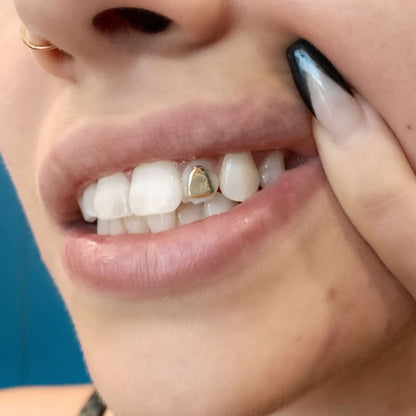 tooth gems, tooth charms, gold teeth gems, gold tooth charms, 18k tooth gems, teeth gems, Swarovski tooth gems, tooth gem application, diamond gems, diamond tooth gems, nike tooth gem, star tooth gem, heart tooth gem, twinkles tooth gems, tooth kandy, dentluxe, sparkle by maya, wholesale tooth gems, tooth gems australia, tooth gems Melbourne, tooth gem training, tooth gem course, mouth house, tooth gem application, temporary tooth gems