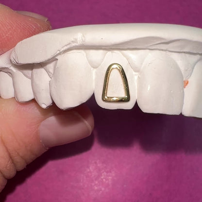 Window Frame Solid Gold Tooth Charm