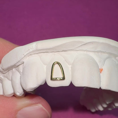 Window Frame Solid Gold Tooth Charm